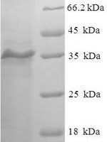 Human Myosin regulatory light chain 2, skeletal muscle isoform (MYLPF) Recombinant Protein - BioCrest Sci