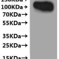 Human T-cell surface antigen CD2 (CD2)-VLPs, Fluorescent Recombinant Protein - BioCrest Sci