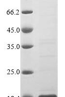 Human Protein S100-A10 (S100A10) Recombinant Protein - BioCrest Sci