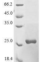 Human Interleukin-10 receptor subunit alpha (IL10RA), partial Recombinant Protein, N-10His/C-Myc - BioCrest Sci