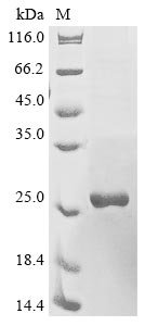 Human Interleukin-10 receptor subunit alpha (IL10RA), partial Recombinant Protein, N-10His/C-Myc, Homo sapiens (Human), Yeast, N-terminal 10xHis-tagged and C-terminal Myc-tagged, 28.7 kDa, purity >≥ 85% as determined by SDS-PAGE.