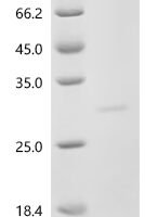 Human Sodium-dependent phosphate transport protein 2B (SLC34A2), partial Recombinant Protein, C-His, aa 191–362 - BioCrest Sci