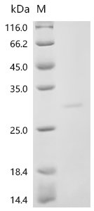 Human Sodium-dependent phosphate transport protein 2B (SLC34A2), partial Recombinant Protein, C-His, aa 191–362, Homo sapiens (Human), E.coli, C-terminal 6xHis-tagged, 26.4 kDa, purity >≥ 85% as determined by SDS-PAGE.