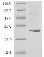 Human Zinc finger protein GLI2 (GLI2), partial Recombinant Protein, N-His-Myc - BioCrest Sci