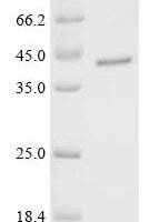 Human Spatacsin (SPG11), partial Recombinant Protein - BioCrest Sci