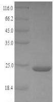 Brugia malayi Protein JTB (JTB), partial Recombinant Protein - BioCrest Sci