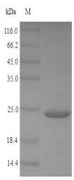 Brugia malayi Protein JTB (JTB), partial Recombinant Protein, Brugia malayi (Filarial nematode worm), E.coli, N-terminal 6xHis-SUMO-tagged, 24.4 kDa, purity >≥ 90% as determined by SDS-PAGE.