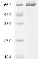 Mouse Desmoglein-3 (Dsg3), partial Recombinant Protein, C-His, aa 50–617, Purity ≥95% - BioCrest Sci
