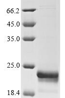 Human Fatty acid-binding protein 5 (FABP5) Recombinant Protein, N-GST - BioCrest Sci