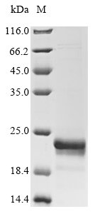 Human Fatty acid-binding protein 5 (FABP5) Recombinant Protein, N-GST, Homo sapiens (Human), E.coli, N-terminal GST-tagged, 42.2 kDa, purity >≥ 90% as determined by SDS-PAGE.