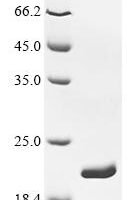 Escherichia coli Dihydrofolate reductase (folA) Recombinant Protein - BioCrest Sci