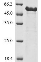 Human Apoptotic protease-activating factor 1 (APAF1), partial Recombinant Protein - BioCrest Sci