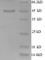 Human Golgi membrane protein 1 (GOLM1), partial Recombinant Protein, N-His - BioCrest Sci