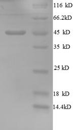 Human Golgi membrane protein 1 (GOLM1), partial Recombinant Protein, N-His, Homo sapiens (Human), E.coli, N-terminal 6xHis-tagged, 45.6 kDa, purity >≥ 90% as determined by SDS-PAGE.