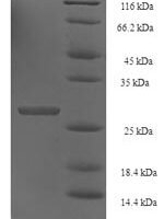 Human Histone H2B type 1-N (HIST1H2BN) Recombinant Protein - BioCrest Sci