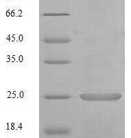 Mouse Calcium/calmodulin-dependent protein kinase II inhibitor 1 (Camk2n1) Recombinant Protein - BioCrest Sci
