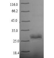 Human Integrin alpha-IIb (ITGA2B), partial Recombinant Protein, N-His, aa 639–887, Yeast - BioCrest Sci