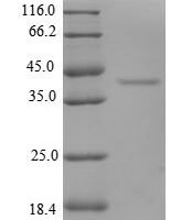 Human Eukaryotic translation initiation factor 1 (EIF1) Recombinant Protein - BioCrest Sci