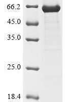 Human Intestinal-type alkaline phosphatase (ALPI) Recombinant Protein, N-His, aa 20–503, E.coli - BioCrest Sci
