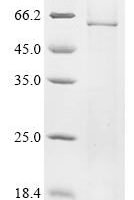 Ricinus communis Glycosyltransferase family 92 protein RCOM_0530710 (RCOM_0530710) Recombinant Protein - BioCrest Sci