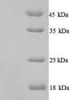 Human Apolipoprotein C-II (APOC2) Recombinant Protein - BioCrest Sci