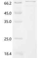 Rat Coiled-coil domain-containing 112 (CCDC112) Recombinant Protein - BioCrest Sci