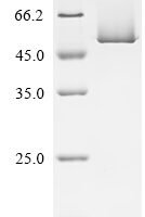 Arabidopsis thaliana TATA-box-binding protein 1 (TBP1) Recombinant Protein, N-His-SUMO - BioCrest Sci