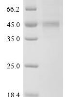 Human Interleukin-20 receptor subunit beta (IL20RB), partial Recombinant Protein - BioCrest Sci