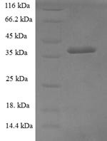 Human Glucosamine-6-phosphate isomerase 1 (GNPDA1) Recombinant Protein - BioCrest Sci