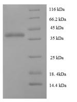 Human Protein DGCR6L (DGCR6L) Recombinant Protein, Homo sapiens (Human), E.coli, N-terminal 6xHis-SUMO-tagged, 40.9 kDa, purity >≥ 90% as determined by SDS-PAGE.