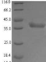 Staphylococcus aureus L-lactate dehydrogenase 1 (ldhA) Recombinant Protein - BioCrest Sci