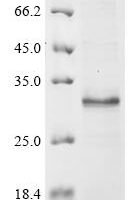 Human Reduced folate transporter (SLC19A1), partial Recombinant Protein - BioCrest Sci