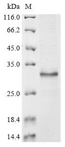 Human Reduced folate transporter (SLC19A1), partial Recombinant Protein, Homo sapiens (Human), E.coli, N-terminal 10xHis-tagged and C-terminal Myc-tagged, 25.5 kDa, purity >≥ 85% as determined by SDS-PAGE.