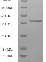 Human MLX-interacting protein (MLXIP) Recombinant Protein - BioCrest Sci