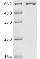 Rat Bifunctional epoxide hydrolase 2 (Ephx2) Recombinant Protein, C-His - BioCrest Sci