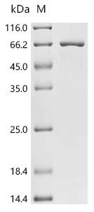 Rat Bifunctional epoxide hydrolase 2 (Ephx2) Recombinant Protein, C-His, Rattus norvegicus (Rat), Baculovirus, C-terminal 6xHis-tagged, 63.4 kDa, purity >≥ 90% as determined by SDS-PAGE.