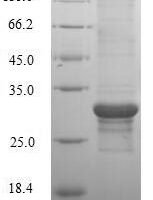 Human Potassium voltage-gated channel subfamily D member 1 protein (KCND1), partial Recombinant Protein - BioCrest Sci