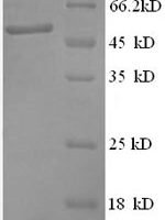 Human Anaphase-promoting complex subunit 5 (ANAPC5), partial Recombinant Protein, N-GST - BioCrest Sci
