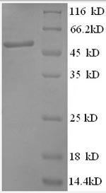 Human Anaphase-promoting complex subunit 5 (ANAPC5), partial Recombinant Protein, N-GST, Homo sapiens (Human), E.coli, N-terminal GST-tagged, 53.2 kDa, purity >≥ 90% as determined by SDS-PAGE.