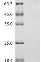 Human Origin recognition complex subunit 1 (ORC1) Recombinant Protein, C-His, aa 1–861, Baculovirus - BioCrest Sci