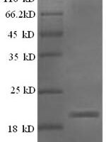 Rat Ephrin-A5 (Efna5) Recombinant Protein, N-His, aa 21–203, E.coli - BioCrest Sci