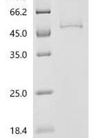 Human UDP-glucuronosyltransferase 1A4(UGT1A4), partial Recombinant Protein - BioCrest Sci