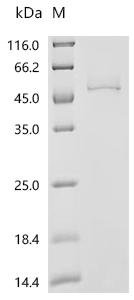 Human UDP-glucuronosyltransferase 1A4(UGT1A4), partial Recombinant Protein, Homo sapiens (Human), Baculovirus, C-terminal 6xHis-tagged, 53.2 kDa, purity >≥ 95% as determined by SDS-PAGE.
