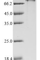 Human E3 ubiquitin-protein ligase RNF168 (RNF168) Recombinant Protein, N-His - BioCrest Sci