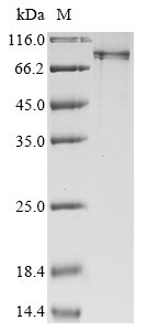Human E3 ubiquitin-protein ligase RNF168 (RNF168) Recombinant Protein, N-His, Homo sapiens (Human), E.coli, N-terminal 6xHis-tagged, 71.0 kDa, purity >≥ 90% as determined by SDS-PAGE.