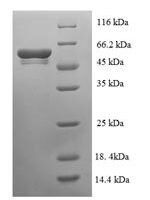 Escherichia coli Glutamate-pyruvate aminotransferase AlaC (alaC) Recombinant Protein - BioCrest Sci