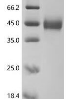 Macaca fascicularis MHC class I polypeptide-related sequence B (MICB), Partial Recombinant Protein - BioCrest Sci