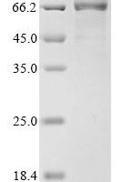 Human Bifunctional 3'-5' exonuclease/ATP-dependent helicase WRN (WRN), partial Recombinant Protein, C-His - BioCrest Sci