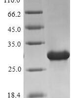 Human Oxytocin-neurophysin 1 (OXT), partial Recombinant Protein, N-10His-SUMO/C-Myc - BioCrest Sci