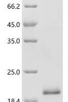Mouse Ly6/PLAUR domain-containing protein 1 (Lypd1) Recombinant Protein - BioCrest Sci